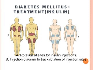 Endocrine week 5 pt | PPT