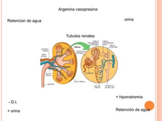 Argenina vasopresina

Retencion de agua                              orina



                       Tubulos renales




                                           + hiponatremia
- D.I.

+ orina                                    Retención de agua
 
