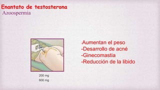 Enantato de testosterona
Azoospermia
200 mg
600 mg
-Aumentan el peso
-Desarrollo de acné
-Ginecomastia
-Reducción de la libido
 