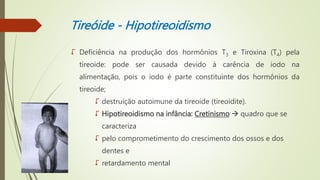 Tireóide - Hipotireoidismo
 Deficiência na produção dos hormônios T3 e Tiroxina (T4) pela
tireoide: pode ser causada devido à carência de iodo na
alimentação, pois o iodo é parte constituinte dos hormônios da
tireoide;
 destruição autoimune da tireoide (tireoidite).
 Hipotireoidismo na infância: Cretinismo 🡪 quadro que se
caracteriza
 pelo comprometimento do crescimento dos ossos e dos
dentes e
 retardamento mental
 
