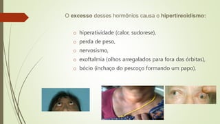 O excesso desses hormônios causa o hipertireoidismo:
o hiperatividade (calor, sudorese),
o perda de peso,
o nervosismo,
o exoftalmia (olhos arregalados para fora das órbitas),
o bócio (inchaço do pescoço formando um papo).
 
