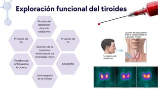 Examen de la
hormona
estimulante de
la tiroides (TSH)
Pruebas de
T3
Pruebas de
T4
Pruebas de
anticuerpos
tiroideos
Ecografía
Gammagrafía
de la tiroides
Prueba de
absorción
de yodo
radiactivo
Exploración funcional del tiroides
 