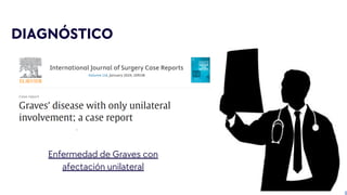 DIAGNÓSTICO
Enfermedad de Graves con
afectación unilateral
 