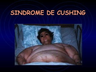 SINDROME DE CUSHING
 