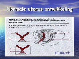 Normale uterus ontwikkelingNormale uterus ontwikkeling
10-16e wk
 