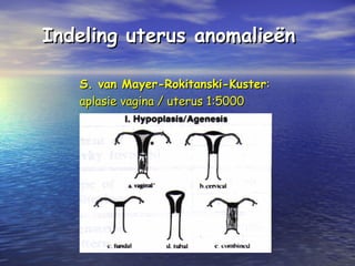 Indeling uterus anomalieënIndeling uterus anomalieën
S. van Mayer-Rokitanski-KusterS. van Mayer-Rokitanski-Kuster::
aplasie vagina / uterus 1:5000aplasie vagina / uterus 1:5000
 