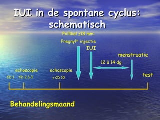 IUI in de spontane cyclus:IUI in de spontane cyclus:
schematischschematisch
CD 1 ± CD 10
echoscopie
IUI
menstruatie
12 à 14 dg
testCD 2 à 3
echoscopie
Follikel ±18 mm:
Pregnyl®®
injectie
Behandelingsmaand
 
