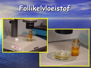 FollikelvloeistofFollikelvloeistof
 
