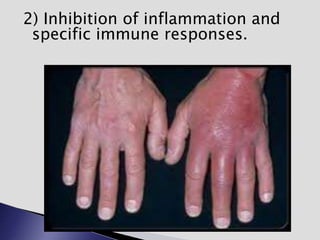 2) Inhibition of inflammation and
specific immune responses.
 