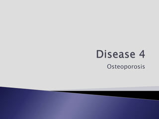 Osteoporosis
 