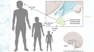 Abnormalities of GH secretion
 Panhypopituitarism
 Dwarfism
 Gigantism
 Acromegaly
 