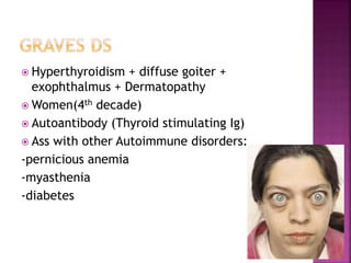  Hyperthyroidism + diffuse goiter +
exophthalmus + Dermatopathy
 Women(4th decade)
 Autoantibody (Thyroid stimulating Ig)
 Ass with other Autoimmune disorders:
-pernicious anemia
-myasthenia
-diabetes
 