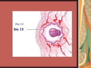 Dia 13 