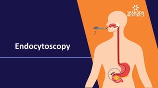 Endocytoscopy
 
