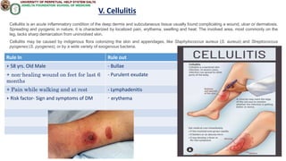 Rule In Rule out
+ 58 yrs. Old Male - Bullae
+ non-healing wound on feet for last 6
months
- Purulent exudate
+ Pain while walking and at rest - Lymphadenitis
+ Risk factor- Sign and symptoms of DM - erythema
V. Cellulitis
Cellulitis is an acute inflammatory condition of the deep dermis and subcutaneous tissue usually found complicating a wound, ulcer or dermatosis.
Spreading and pyogenic in nature, it is characterized by localized pain, erythema, swelling and heat. The involved area, most commonly on the
leg, lacks sharp demarcation from uninvolved skin.
Cellulitis may be caused by indigenous flora colonizing the skin and appendages, like Staphylococcus aureus (S. aureus) and Streptococcus
pyogenes (S. pyogenes), or by a wide variety of exogenous bacteria.
 
