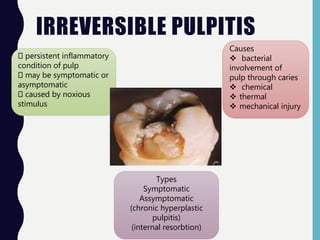 IRREVERSIBLE PULPITIS
persistent inflammatory
condition of pulp
may be symptomatic or
asymptomatic
caused by noxious
stimulus
Causes
 bacterial
involvement of
pulp through caries
 chemical
 thermal
 mechanical injury
Types
Symptomatic
Assymptomatic
(chronic hyperplastic
pulpitis)
(internal resorbtion)
 