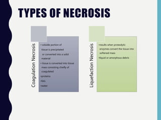TYPES OF NECROSIS
CoagulationNecrosis
• soluble portion of
tissue is precipitated
or converted into a solid
material
• tissue is converted into tissue
mass consisting chiefly of
coagulated
•proteins
•fats
•water
LiquefactionNecrosis
•results when proteolytic
enzymes convert the tissue into
softened mass
•liquid or amorphous debris
 