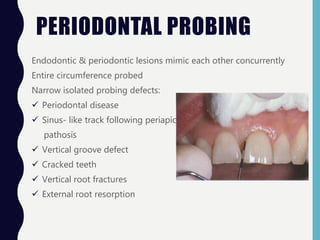 PERIODONTAL PROBING
Endodontic & periodontic lesions mimic each other concurrently
Entire circumference probed
Narrow isolated probing defects:
 Periodontal disease
 Sinus- like track following periapical
pathosis
 Vertical groove defect
 Cracked teeth
 Vertical root fractures
 External root resorption
 