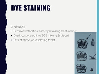 DYE STAINING
3 methods:
• Remove restoration: Directly revealing fracture line
• Dye incorporated into ZOE mixture & placed
• Patient chews on disclosing tablet
 
