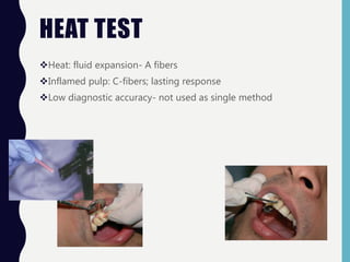HEAT TEST
Heat: fluid expansion- A fibers
Inflamed pulp: C-fibers; lasting response
Low diagnostic accuracy- not used as single method
 