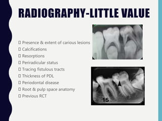 RADIOGRAPHY-LITTLE VALUE
Presence & extent of carious lesions
Calcifications
Resorptions
Periradicular status
Tracing fistulous tracts
Thickness of PDL
Periodontal disease
Root & pulp space anatomy
Previous RCT
 