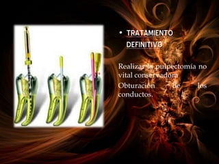 • TRATAMIENTO
DEFINITIVO
Realizar la pulpectomía no
vital conservadora
Obturación de los
conductos.
 