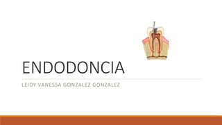 ENDODONCIA
LEIDY VANESSA GONZALEZ GONZALEZ
 