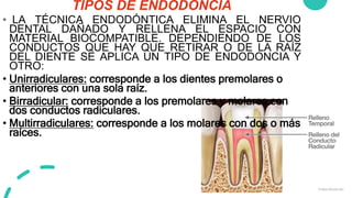 TIPOS DE ENDODONCIA
• LA TÉCNICA ENDODÓNTICA ELIMINA EL NERVIO
DENTAL DAÑADO Y RELLENA EL ESPACIO CON
MATERIAL BIOCOMPATIBLE. DEPENDIENDO DE LOS
CONDUCTOS QUE HAY QUE RETIRAR O DE LA RAÍZ
DEL DIENTE SE APLICA UN TIPO DE ENDODONCIA Y
OTRO:
• Unirradiculares: corresponde a los dientes premolares o
anteriores con una sola raíz.
• Birradicular: corresponde a los premolares y molares con
dos conductos radiculares.
• Multirradiculares: corresponde a los molares con dos o más
raíces.
 