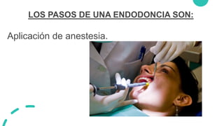 LOS PASOS DE UNA ENDODONCIA SON:
Aplicación de anestesia.
 