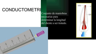 CONDUCTOMETRIA
 
