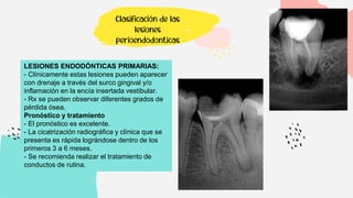 LESIONES ENDODÓNTICAS PRIMARIAS:
- Clínicamente estas lesiones pueden aparecer
con drenaje a través del surco gingival y/o
inflamación en la encía insertada vestibular.
- Rx se pueden observar diferentes grados de
pérdida ósea.
Pronóstico y tratamiento
- El pronóstico es excelente.
- La cicatrización radiográfica y clínica que se
presenta es rápida lográndose dentro de los
primeros 3 a 6 meses.
- Se recomienda realizar el tratamiento de
conductos de rutina.
Clasificación de las
lesiones
perioendodonticas
 