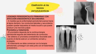 Clasificación de las
lesiones
perioendodonticas
LESIONES PERIODONTALES PRIMARIAS CON
AFECCIÓN ENDODÓNTICA SECUNDARIA:
- A medida que la enfermedad periodontal avanza hacia
el ápice dentario, los conductos laterales y secundarios
pueden quedar expuestos al medio bucal lo que puede
producir una necrosis pulpar.
Pronóstico y tratamiento
- El pronóstico depende de la continua terapia
periodontal seguida del tratamiento de conductos.
- Se obtiene un pronóstico endodóntico favorable solo
cuando el diente está en un ambiente cerrado y
protegido.
- El tratamiento se debe comenzar con la terapia
periodontal y proseguir con esta junto con el tratamiento
endodóntico.
 