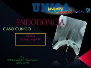 UNICA
Odontología IV
Por:
Natalia Morales Manzanares
(2012-0074)
 