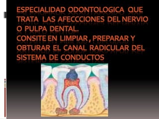EspecialidadOdontologicaqueTratalasafeccciones  del nervio  o  pulpa  dental.Consite en  limpiar , preparar  y  obturar  el  canal  radicular  del  sistema  de  conductos 
