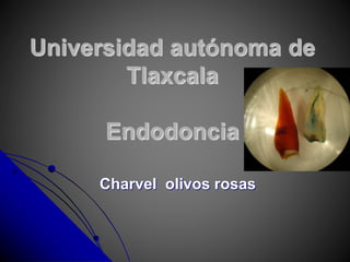 Universidad autónoma de
Tlaxcala
Endodoncia
Charvel olivos rosas
 