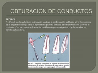 TECNICA:
A.- Con el auxilio del ultimo instrumento usado en la conformación ,calibrado a 2 o 3 mm menos
de la longitud de trabajo tome la espatula una pequeña cantidad de cemento sellador y llévelo al
conducto . Con movimientos de rotación anti horario procure depositar el sellador sobre las
paredes del conducto.
 