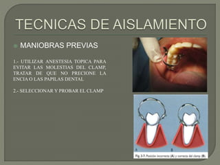  MANIOBRAS PREVIAS
1.- UTILIZAR ANESTESIA TOPICA PARA
EVITAR LAS MOLESTIAS DEL CLAMP,
TRATAR DE QUE NO PRECIONE LA
ENCIA O LAS PAPILAS DENTAL
2.- SELECCIONAR Y PROBAR EL CLAMP
 