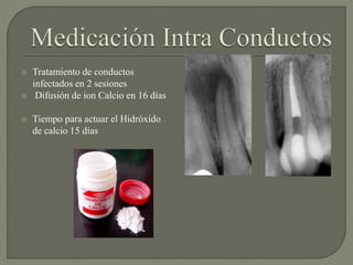  Tratamiento de conductos
infectados en 2 sesiones
 Difusión de ion Calcio en 16 días
 Tiempo para actuar el Hidróxido
de calcio 15 días
 