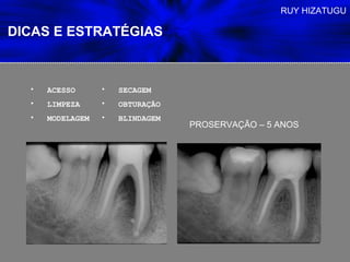 RUY HIZATUGU

DICAS E ESTRATÉGIAS



  •   ACESSO      •   SECAGEM
  •   LIMPEZA     •   OBTURAÇÃO
  •   MODELAGEM   •   BLINDAGEM
                                  PROSERVAÇÃO – 5 ANOS
 