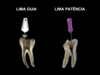 LIMA GUIA   LIMA PATÊNCIA
 
