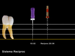10/.02   Reciproc 25/.08




Sistema Reciproc
 