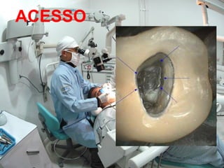 ACESSO
         OPTO
 