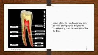 Jonathan Cardoso 7
Canal lateral é a ramificação que corre
do canal principal para a região do
periodonto, geralmente no terço médio
do dente.
 