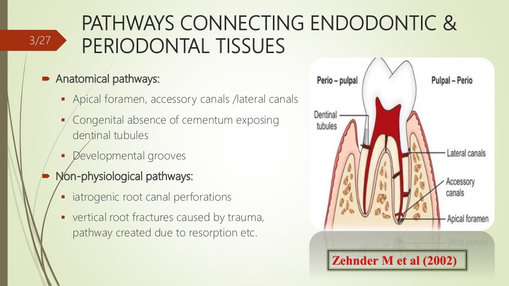 Endodontic periodontal interactions