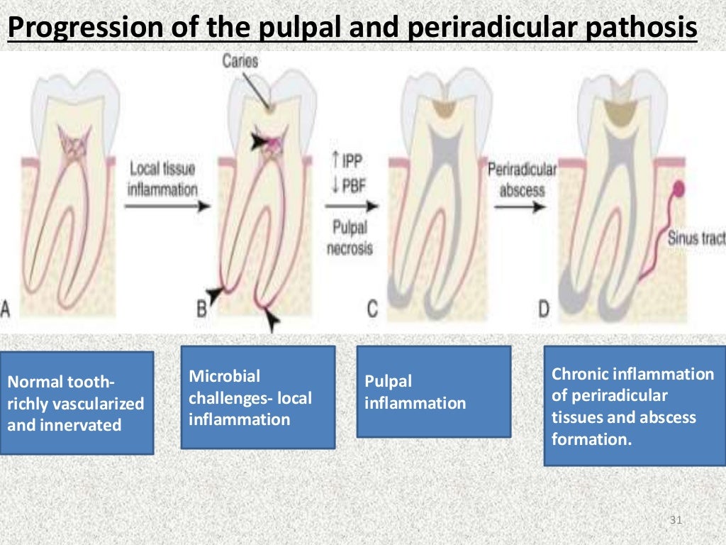Endodontic periodontic interrelationship