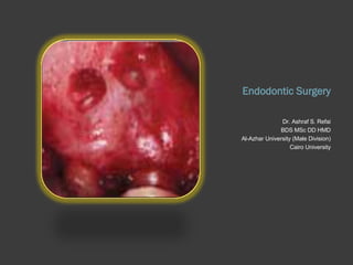 Endodontic Surgery ,[object Object],[object Object],[object Object],[object Object]