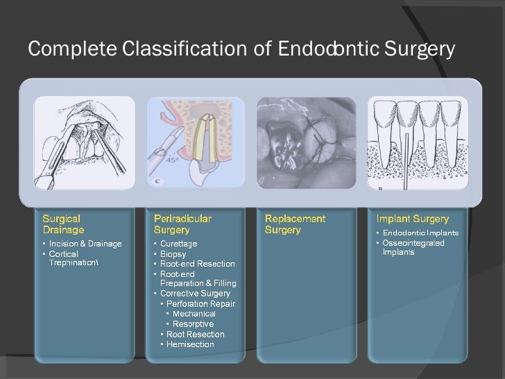 Endodontic Surgery