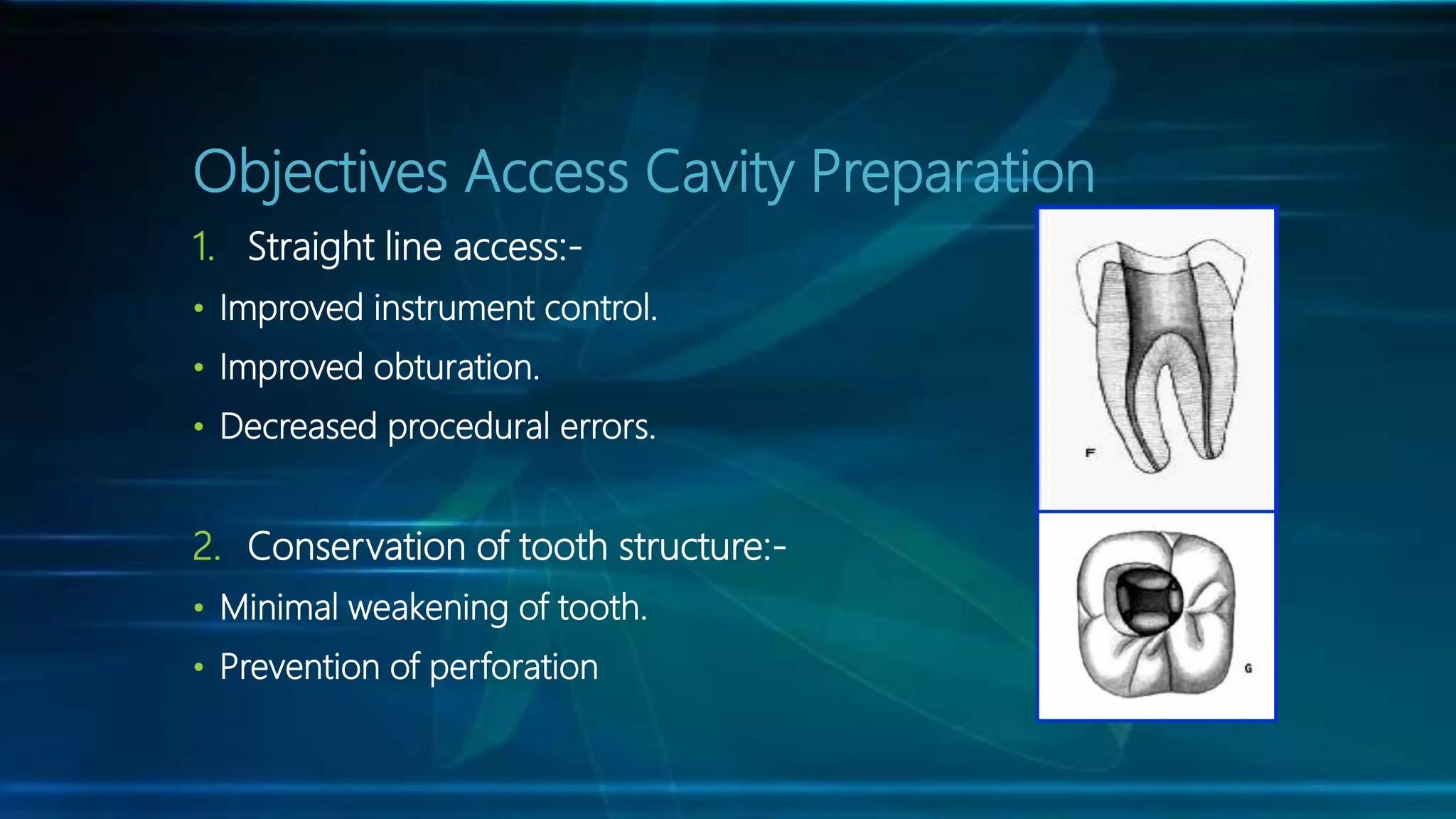 Endodontic Access Cavity Preparation PPT
