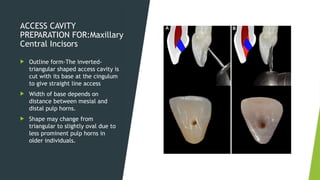 Endodontic Access Cavity Preparation.1.pptx