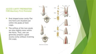 Endodontic Access Cavity Preparation.1.pptx